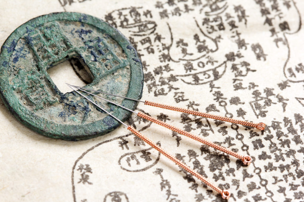 l'acupuncture