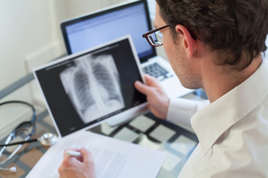 Tuberculose active