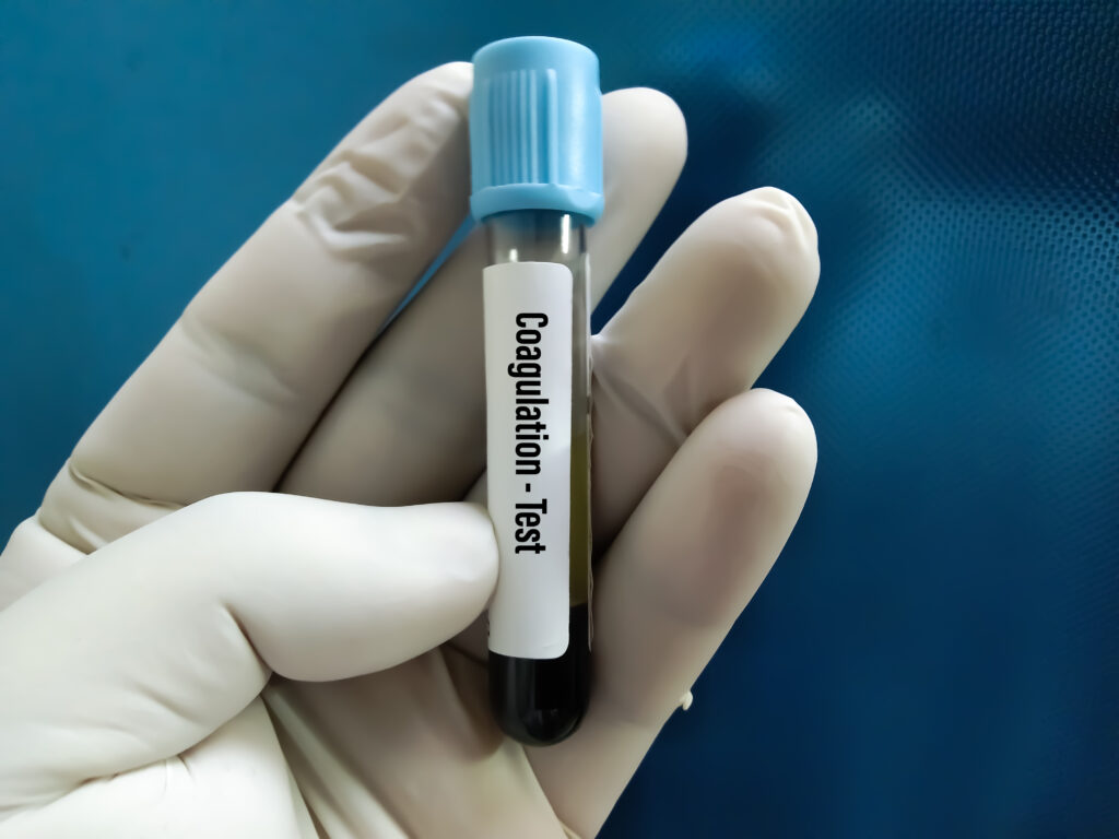 hémophilie